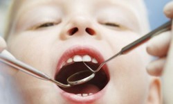 7 Tips for Taking Your Child to the Dentist