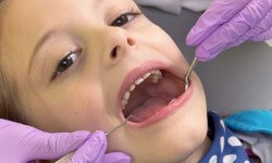Why should you take your child to a Pediatric Dentist?