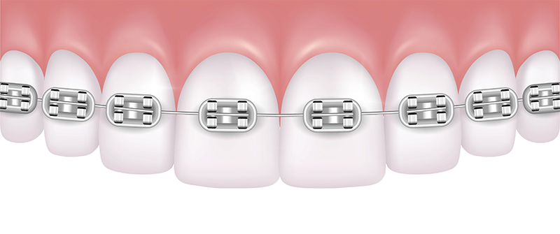 visit the orthodontist