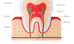 How to Prevent Enamel Erosion